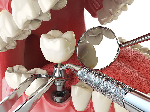 Best Emergency Dental Care for Trauma or Injury in Lakewood Park, TN